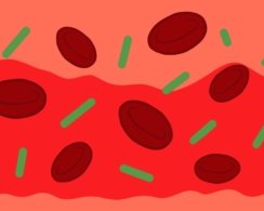 Что такое сепсис, как его диагностируют и лечат