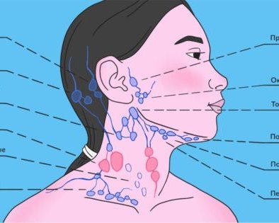 Почему воспаляются лимфоузлы на шее и что с этим делать